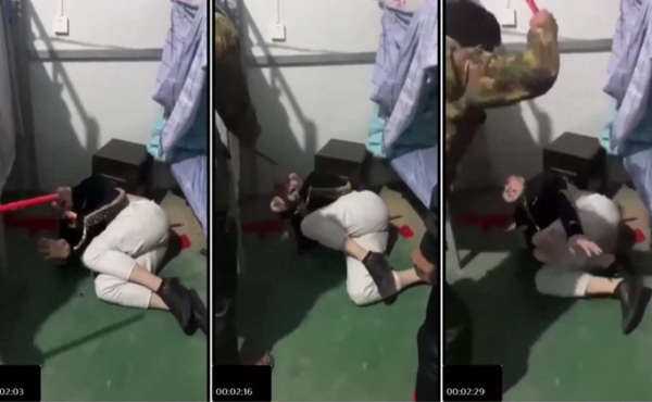 真实缅北活埋电击殴打枪击合集-大漠瓜客-免费吃瓜